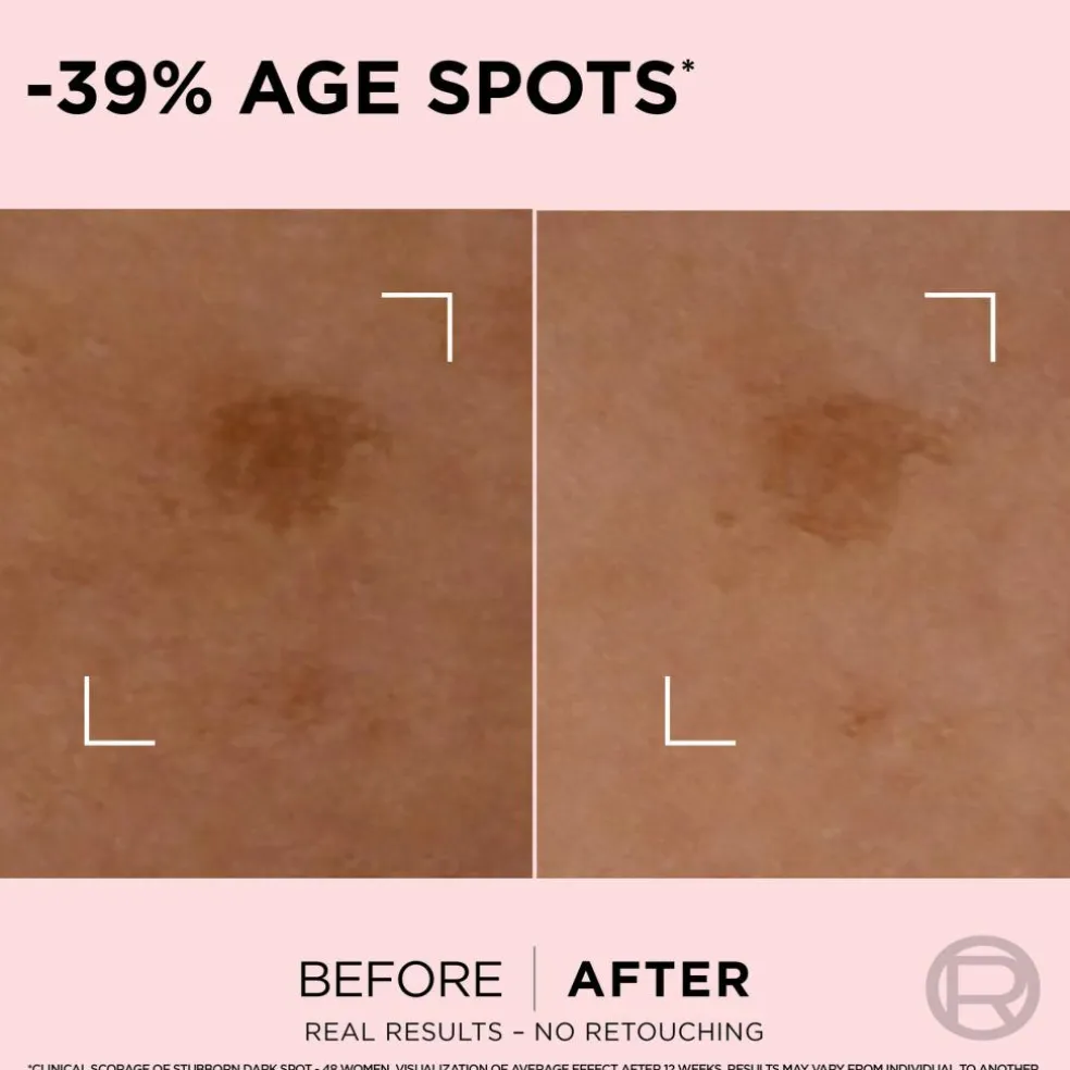 Age Perfect Golden Age Spot Corrector