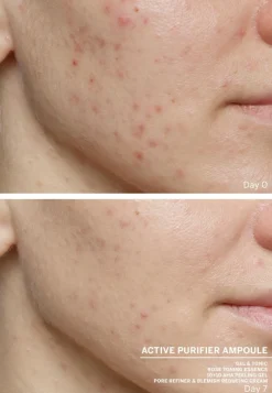 Ampoule Concentrates Active Purifier