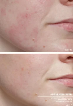 Ampoule Concentrates Algae Vitalizer