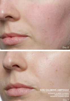 Ampoule Concentrates SOS Calming