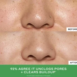 BALANCE Detox Drops 2% Salicylic Acid Toner