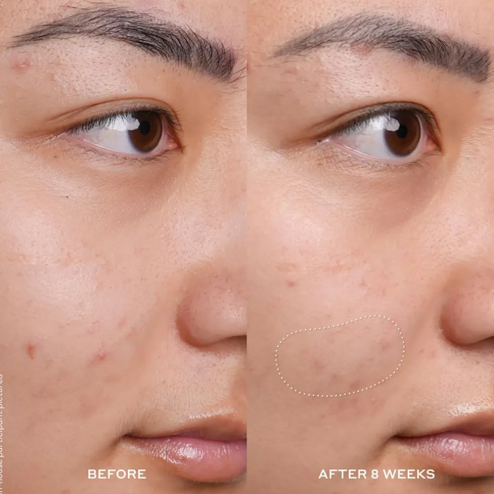 Banana Bright Vitamin C Serum