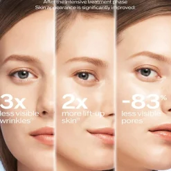 Bio Performance 2.0 Micro Needle