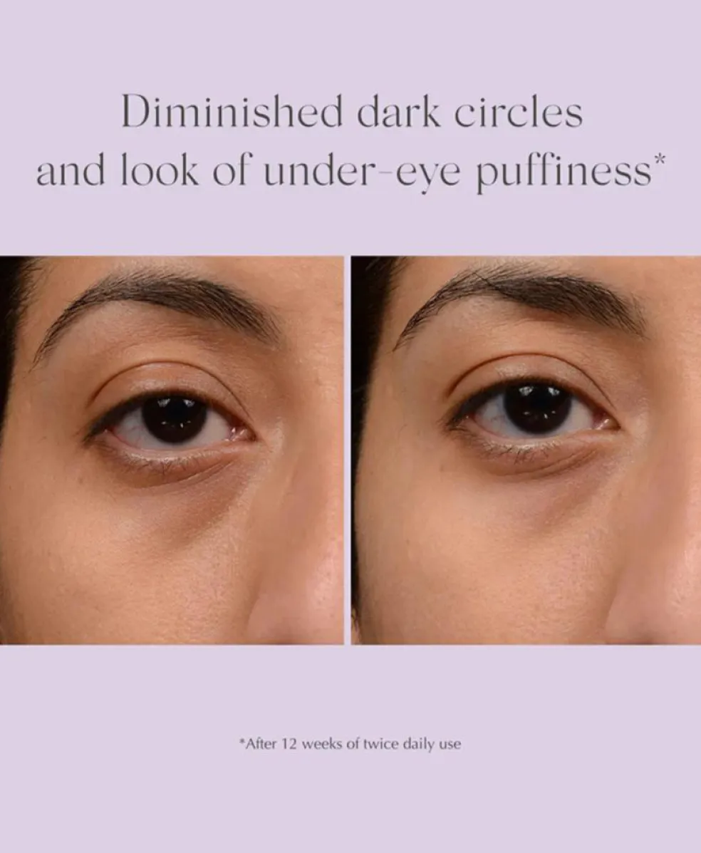 Bright Eyes Dark Circle Corrector