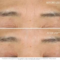 Capture Totale Hyalushot - Wrinkle Corrector