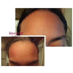 CIT Face Roller Basic Kit