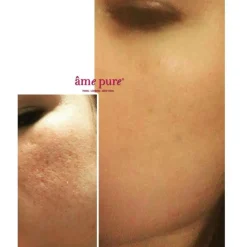 CIT Face Roller Basic Kit