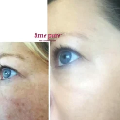 CIT Face Roller Basic Kit