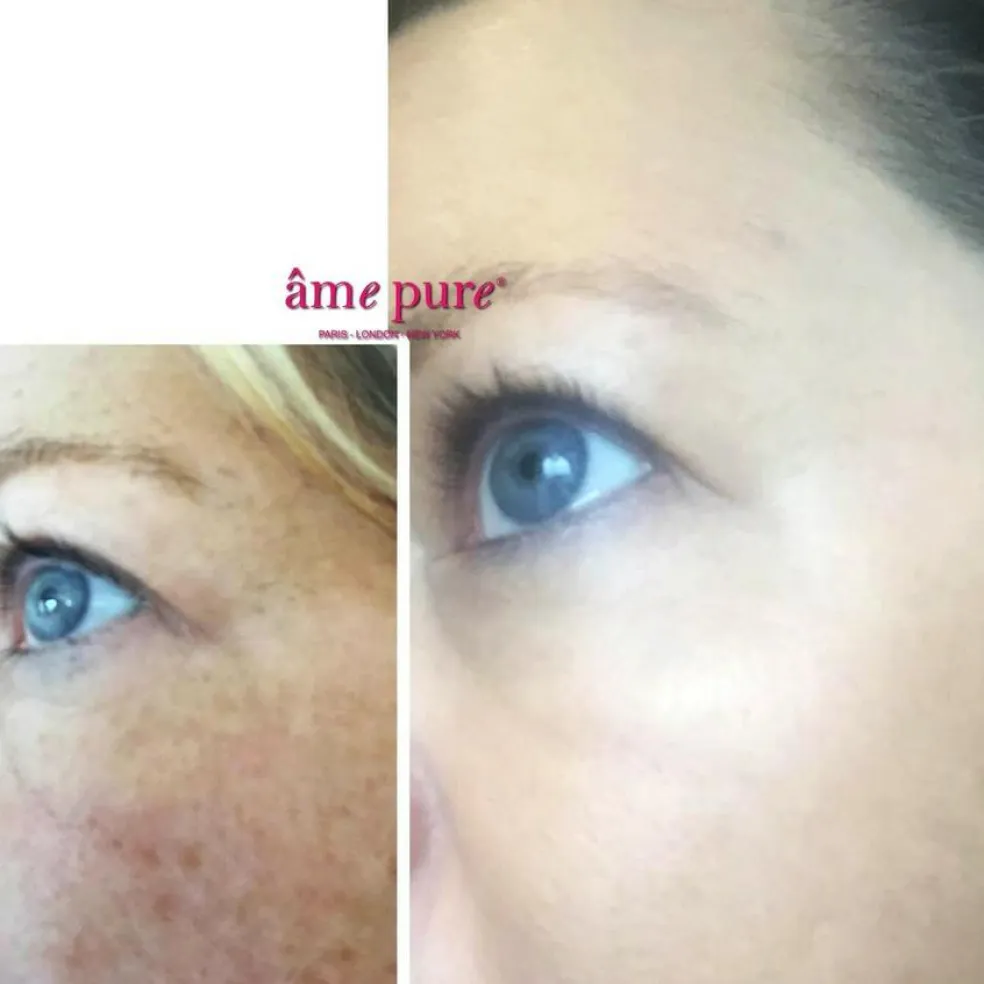 CIT Face Roller Basic Kit