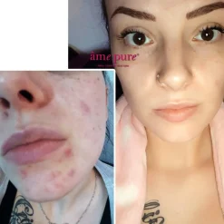 CIT Face Roller Platinum Kit