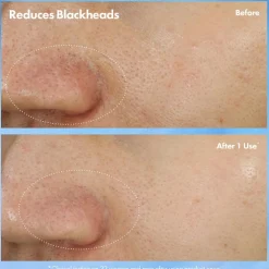 Clear Improvement Blackhead Clearing Mask-To-Scrub