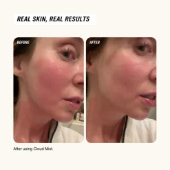 Cloud Mist SOS Recovery Spray