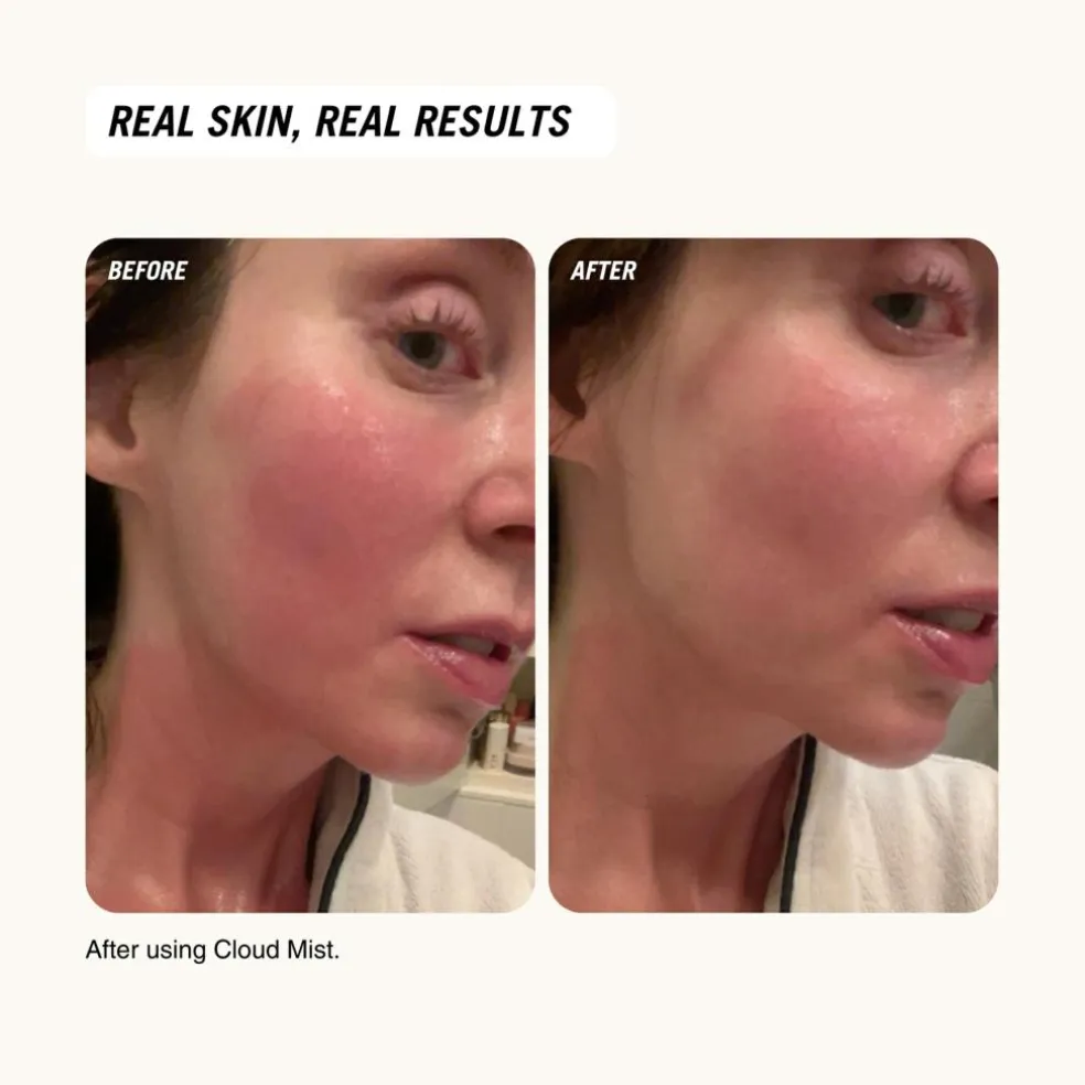 Cloud Mist SOS Recovery Spray