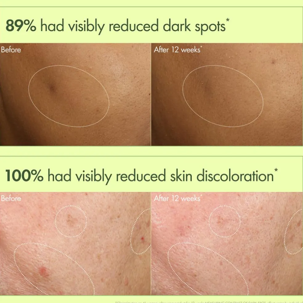 Dr. Weil Mega-Mushroom Dark Spot Correcting Brightening Serum