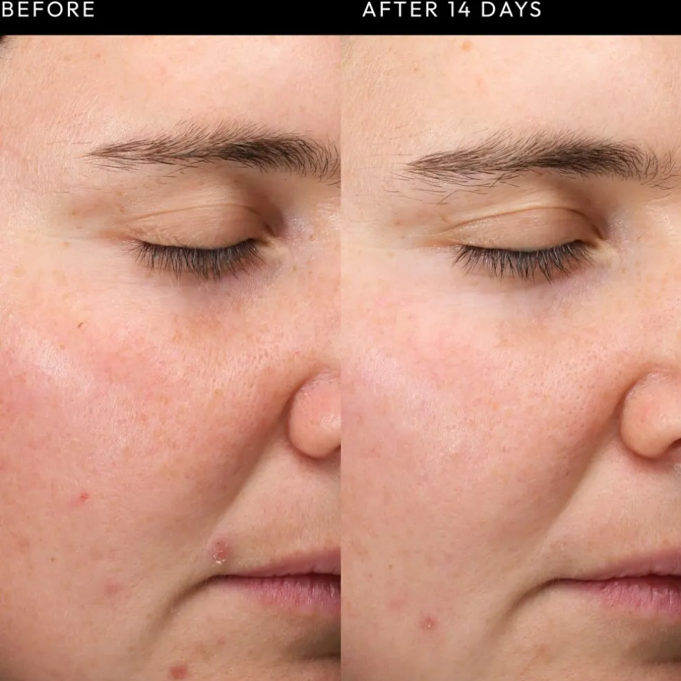 Exosome Hydro-Glow Complex