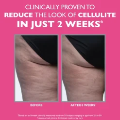 FIRMx® Tight & Toned Cellulite Treatment