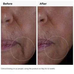 GF 15% Solution Serum