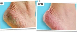 Healthy Feet Foot Cream