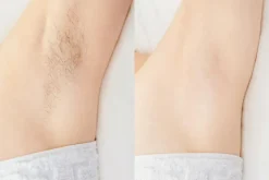 HEVI Bodysugaring