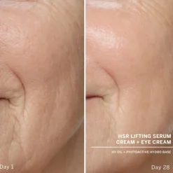 HSR Lifting Serum