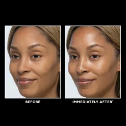 Instant FIRMx® Glow-Filter Priming