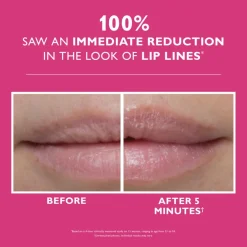 Instant FIRMx® Lip Filler