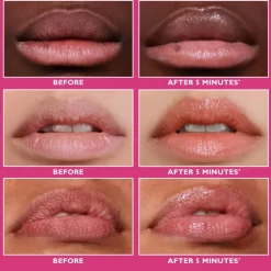 Instant FIRMx® Lip Filler