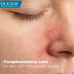 Kelual DS Anti-Scales & Redness Soothing Cream