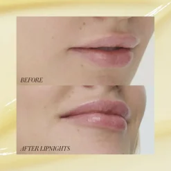 Lip Mask