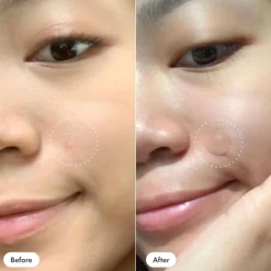 Mighty Patch Invisible+