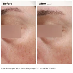 Niacinamide 5% Face and Body Emulsion