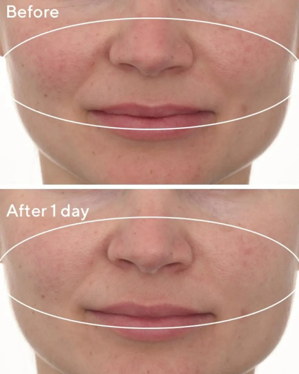 Omega Deep Hydration Repair Mask