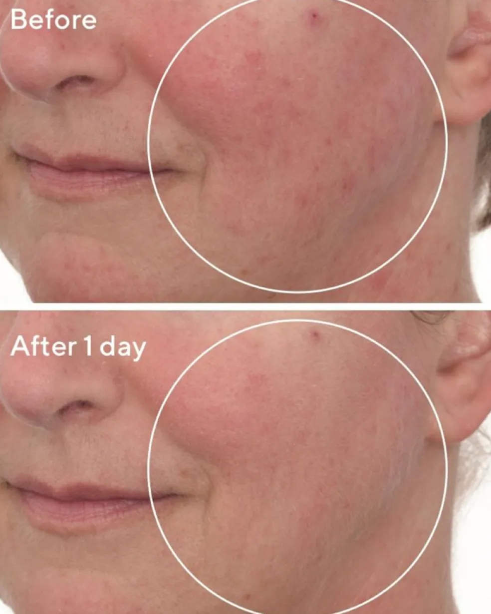 Omega Deep Hydration Repair Mask