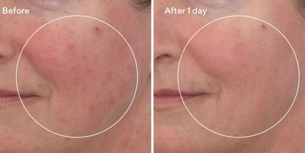 Omega Deep Hydration Repair Mask