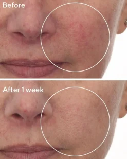 Omega Deep Repair Serum