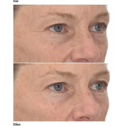 Retinol Youth Renewal Eye Masks