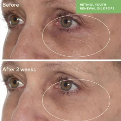 Retinol Youth Renewal Oil Drops