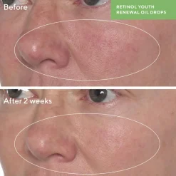 Retinol Youth Renewal Oil Drops