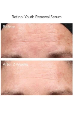 Retinol Youth Renewal Serum