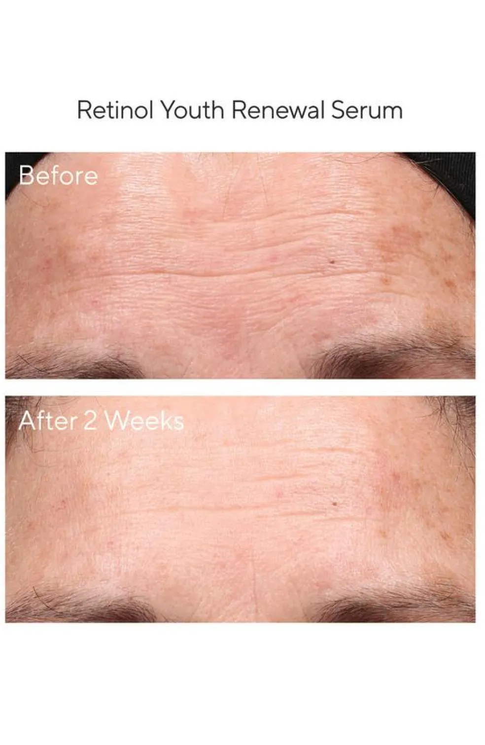 Retinol Youth Renewal Serum