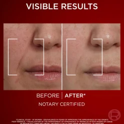 Revitalift Laser Day Cream for Normal Skin