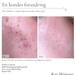 Rich Face Creme SPF 30