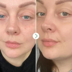 Rosehip Bioregenerate