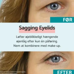 Sagging Eyelids
