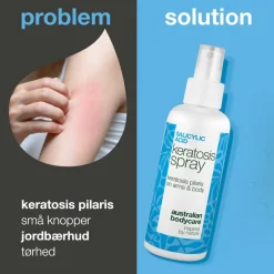 Salicylic Acid Keratosis spray