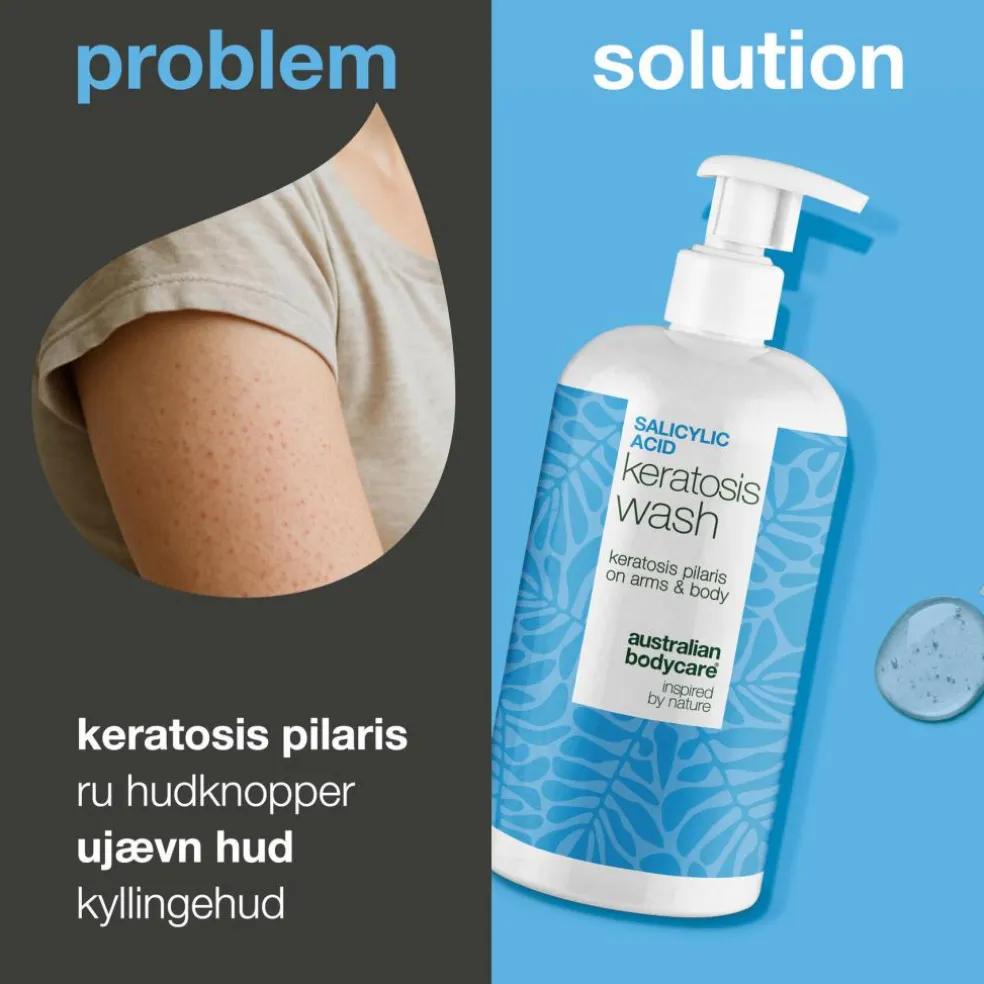 Salicylic Acid Keratosis Wash