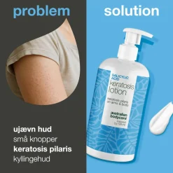 Salicylic Acid Keratosis lotion