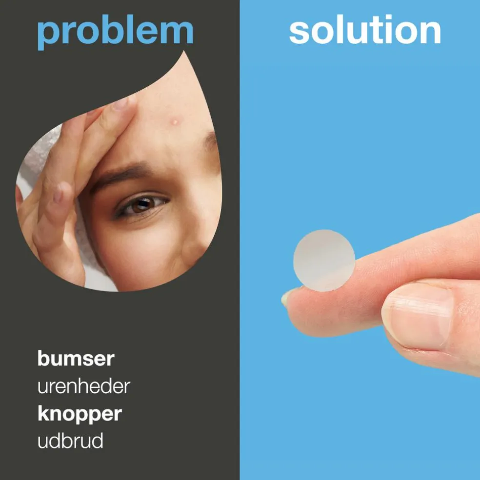 Salicylic Acid Pimple Patches