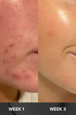 Skin Perfecting 2% BHA Liquid Exfoliant