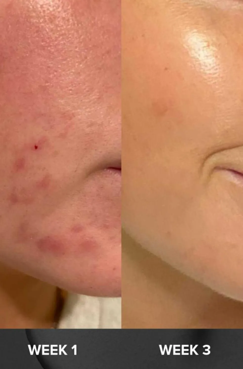 Skin Perfecting 2% BHA Liquid Exfoliant